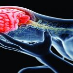 मस्तिष्कघात के रोगियों को जरूरत है हम सभी के ‘सपोर्ट’ की